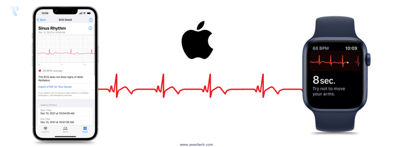 Apple ecg app